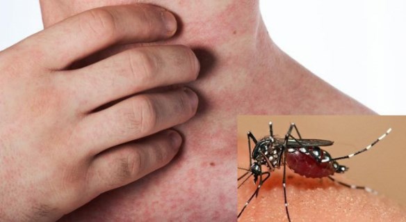 Không phun diệt côn trùng gây ra bệnh lý nguy hiểm đến sức khỏe